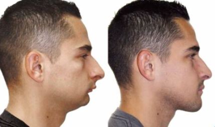 سن ارتودنسی