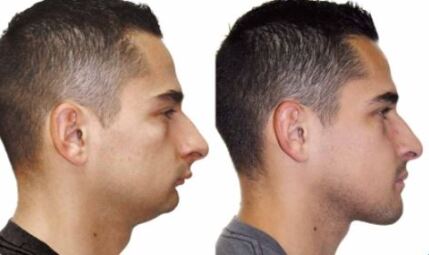 سن ارتودنسی