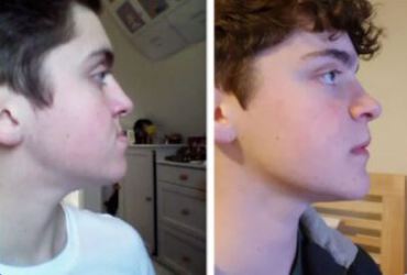 ارتودنسی کودکان و نوجوانان 