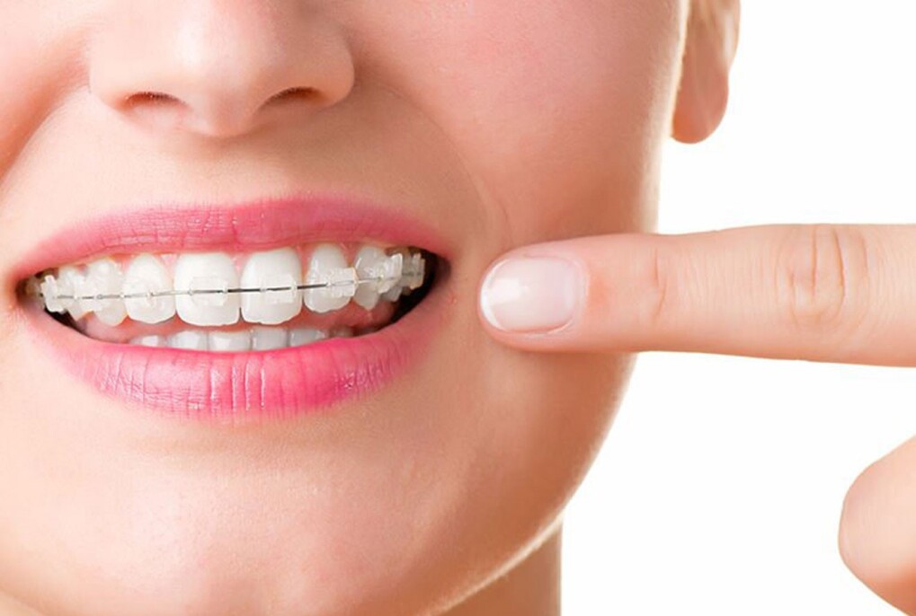 ارتودنسی و رفع ناهنجاری های فک