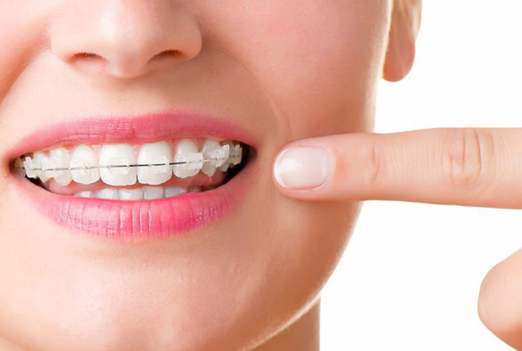 ارتودنسی و رفع ناهنجاری های فک