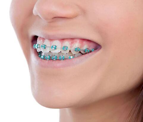 صفحه اول ارتودنسی